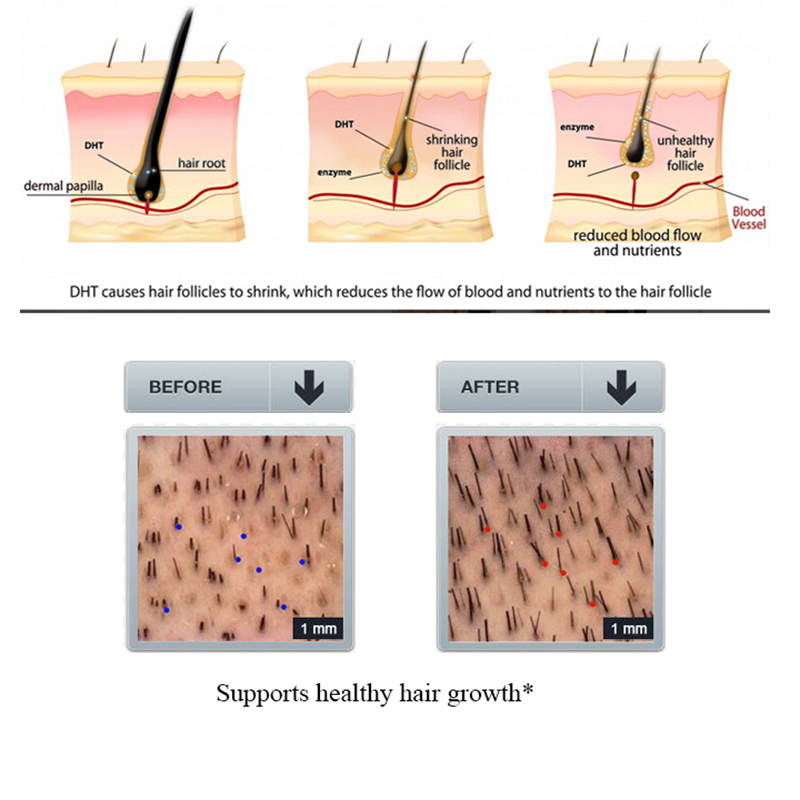 PURC Ginger Hair Loss แชมพูโสม - Licorice Root Sticks บทวิจารณ์และราคา
